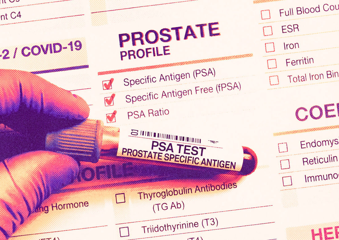 PSA & Prostate Blood Tests: What Australian Men Need