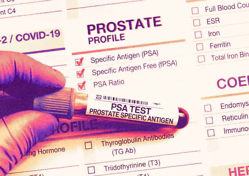 PSA & Prostate Blood Tests: What Australian Men Need – Bloody Good
