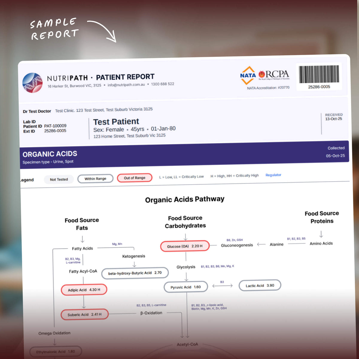 Organic Acids Metabolomic Mapping Urine Test Kit