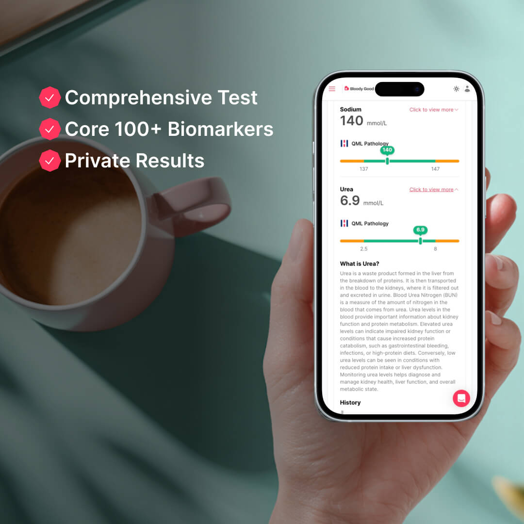 The Bloody Good Test